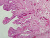 gallbladder2~0.jpg
