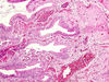 gallbladder3~0.jpg