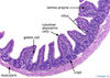 ileum20x.jpg