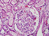 kidney4~0.jpg