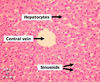 Filename=liver2F.jpg
Filesize=166KiB
Dimensions=400x328
Date added=Jun 03, 2008 liver2F.jpg