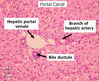 Filename=liver3~1.jpg
Filesize=165KiB
Dimensions=401x327
Date added=Jun 03, 2008 liver3~1.jpg