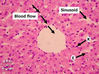 Filename=liver4F.jpg
Filesize=155KiB
Dimensions=399x299
Date added=Jun 03, 2008 liver4F.jpg