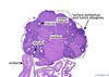 Filename=ovary4x.jpg
Filesize=236KiB
Dimensions=800x568
Date added=Sep 06, 2007 ovary4x.jpg