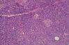 pancreas2.jpg