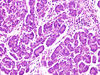 pancreas4~1.jpg