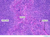 Filename=spleen20x.jpg
Filesize=499KiB
Dimensions=800x598
Date added=Sep 06, 2007 spleen20x.jpg
