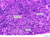 Filename=spleenredpulp40x.jpg
Filesize=379KiB
Dimensions=800x598
Date added=Sep 06, 2007 spleenredpulp40x.jpg