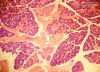 Filename=submandibular4X.jpg
Filesize=439KiB
Dimensions=800x579
Date added=Apr 27, 2009 submandibular4X.jpg