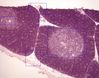 thymus10_0.jpg
