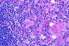 thymus1~0.jpg