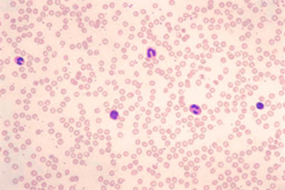 Blood Microscope Slides