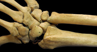 bones for Histology - World