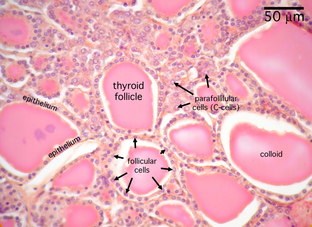 thyroid40X_lbl.jpg