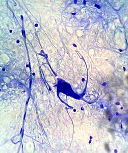 Neuron - histology slide
Image by Fanny CASTETS, via Wikimedia Commons. 

Original file source: [url=https://commons.wikimedia.org/wiki/File:Neuronehisto.jpg]https://commons.wikimedia.org/wiki/File:Neuronehisto.jpg[/url]

Title: "Neuronehisto.jpg"

No changes were made to the original image downloaded.  

Permission is granted to copy, distribute and/or modify this document under the terms of the GNU Free Documentation License, Version 1.2 or any later version published by the Free Software Foundation; with no Invariant Sections, no Front-Cover Texts, and no Back-Cover Texts. A copy of the license is included in the section entitled GNU Free Documentation License. [url=https://commons.wikimedia.org/wiki/Commons:GNU_Free_Documentation_License,_version_1.2]https://commons.wikimedia.org/wiki/Commons:GNU_Free_Documentation_License,_version_1.2[/url]

This file is licensed under the Creative Commons Attribution-Share Alike 3.0 Unported License [url=https://creativecommons.org/licenses/by-sa/3.0/deed.en/]https://creativecommons.org/licenses/by-sa/3.0/deed.en/[/url]

This file is licensed under the Creative Commons Attribution-ShareAlike [url=https://creativecommons.org/licenses/by-sa/2.5/deed.en]2.5 Generic[/url], [url=https://creativecommons.org/licenses/by-sa/2.0/deed.en]2.0 Generic[/url] and [url=https://creativecommons.org/licenses/by-sa/1.0/deed.en]1.0 Generic[/url] license.


