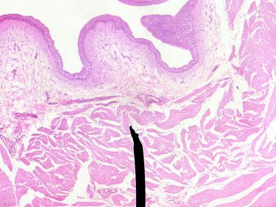 Bladder - histology slide
This is a histology slide of the bladder.

Image by Jpogi via Wikipedia. Public domain.

No changes were made to the original image downloaded (note: this version was downloaded at reduced resolution from Wikipedia).

