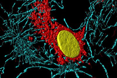 Fibroblast – histology slide
Microfilaments, mitochondria and nucleus in fibroblast cells.

Histology slide courtesy of Heiti Paves, via Wikimedia Commons. No changes were made from the download.  

Original file source: [url=https://commons.wikimedia.org/wiki/File:Fibroblast_(BPAE).jpg]https://commons.wikimedia.org/wiki/File:Fibroblast_(BPAE).jpg[/url]

This file is licensed under the Creative Commons Attribution-Share Alike 3.0 Unported license. [url=https://creativecommons.org/licenses/by-sa/3.0/deed.en/]https://creativecommons.org/licenses/by-sa/3.0/deed.en/[/url]

Keywords: fibers
