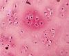Filename=Hyaline_cartilage.jpg
Filesize=62KiB
Dimensions=443x362
Date added=Oct 25, 2025 Hyaline_cartilage.jpg