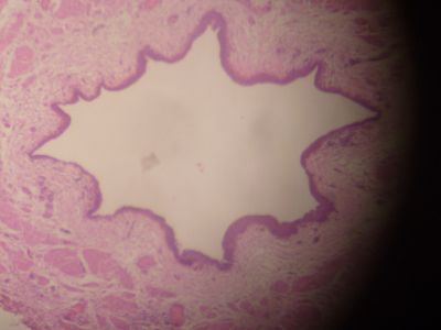 Ureeter - histology slide
This is a histology slide of the ureter.

Image by Jpogi at English Wikipedia, via Wikimedia Commons. Public domain.

No changes were made to the original image downloaded (note: this version was downloaded at reduced resolution from Wikimedia Commons).

