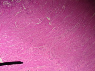 Uterus - histology slide
This is a histology slide of the uterus.

Image by Jpogi at English Wikipedia, via Wikimedia Commons. Public domain.

No changes were made to the original image downloaded (note: this version was downloaded at reduced resolution from Wikimedia Commons).

