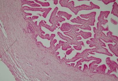 Oviduct - histology slide
Image by Department of Histology, Jagiellonian University Medical College ([url=http://histologia.cm-uj.krakow.pl/index.html]1[/url]; [url=https://web.archive.org/web/20060216212659/http://www.histologia.cm-uj.krakow.pl/index.html]archive copy[/url] at the Wayback Machine), via Wikimedia Commons.

Original file source: [url=https://commons.wikimedia.org/wiki/File:Oviduct-histo.jpg]https://commons.wikimedia.org/wiki/File:Oviduct-histo.jpg[/url]

Title: "Oviduct-histo.jpg"

No changes were made to the original image downloaded. 

Permission is granted to copy, distribute and/or modify this document under the terms of the GNU Free Documentation License, Version 1.2 or any later version published by the Free Software Foundation; with no Invariant Sections, no Front-Cover Texts, and no Back-Cover Texts. A copy of the license is included in the section entitled GNU Free Documentation License. [url=https://commons.wikimedia.org/wiki/Commons:GNU_Free_Documentation_License,_version_1.2]https://commons.wikimedia.org/wiki/Commons:GNU_Free_Documentation_License,_version_1.2[/url]

This file is licensed under the Creative Commons Attribution-Share Alike 3.0 Unported License [url=https://creativecommons.org/licenses/by-sa/3.0/deed.en/]https://creativecommons.org/licenses/by-sa/3.0/deed.en/[/url]


