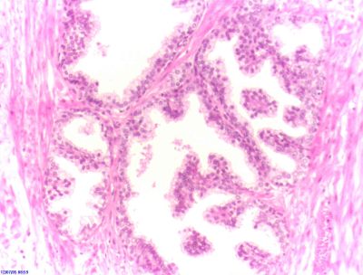 Prostate - histology slide
Microsopic view (Hematoxilin & Eosin, 100x) of normal tissue from the human prostate. Normal glands and fibromuscolar stroma is visible. (Description text from the Wikimedia Commons file page.)

Image by Alex_brollo, via Wikimedia Commons. 

Original file source: [url=https://commons.wikimedia.org/wiki/File:Prostate_normal_1.jpg]https://commons.wikimedia.org/wiki/File:Prostate_normal_1.jpg[/url]

Title: "Prostate_normal_1.jpg"

No changes were made to the original image downloaded. 

This file is licensed under the Creative Commons Attribution-Share Alike 4.0 International license. [url=https://creativecommons.org/licenses/by-sa/4.0/deed.en] https://creativecommons.org/licenses/by-sa/4.0/deed.en/[/url] 

