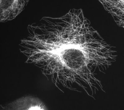 Microtubules
Image courtesy of Jeffrey81 at Dutch Wikipedia, via Wikimedia Commons. No changes were made from the download.  

Original file source: [url=https://commons.wikimedia.org/wiki/File:Btub.jpg]https://commons.wikimedia.org/wiki/File:Btub.jpg[/url]

Permission is granted to copy, distribute and/or modify this document under the terms of the GNU Free Documentation License, Version 1.2 or any later version published by the Free Software Foundation; with no Invariant Sections, no Front-Cover Texts, and no Back-Cover Texts. A copy of the license is included in the section entitled GNU Free Documentation License. [url=https://commons.wikimedia.org/wiki/Commons:GNU_Free_Documentation_License,_version_1.2]https://commons.wikimedia.org/wiki/Commons:GNU_Free_Documentation_License,_version_1.2[/url]

This file is licensed under the Creative Commons Attribution-Share Alike 3.0 Unported license. [url=https://creativecommons.org/licenses/by-sa/3.0/deed.en/]https://creativecommons.org/licenses/by-sa/3.0/deed.en/[/url]

