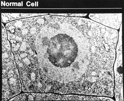 Cell
Title: Normal Cell

Image: [url=https://visualsonline.cancer.gov/details.cfm?imageid=2158]https://visualsonline.cancer.gov/details.cfm?imageid=2158[/url]

Originator: NCI

Source: The Web site of the National Cancer Institute ([url=https://www.cancer.gov]https://www.cancer.gov[/url])

Creator: Unknown Photographer

