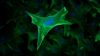 Filename=fibroblast.jpg
Filesize=637KiB
Dimensions=1920x1080
Date added=Oct 24, 2025 fibroblast.jpg