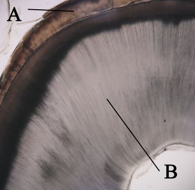 Cross-section of tooth (labels) – histology slide
Histologic cross-section of tooth showing enamel, labeled A, and dentin, labeled B. (Description text from the Wikimedia Commons file page.)

Image by [url=https://commons.wikimedia.org/wiki/User:Dozenist]Dozenist[/url], via Wikimedia Commons. 

Original file source: [url=https://commons.wikimedia.org/wiki/File:Crosssectiontooth11-24-05.jpg]https://commons.wikimedia.org/wiki/File:Crosssectiontooth11-24-05.jpg[/url]

Title: "Crosssectiontooth11-24-05.jpg"

No changes were made to the original image downloaded.  

Permission is granted to copy, distribute and/or modify this document under the terms of the GNU Free Documentation License, Version 1.2 or any later version published by the Free Software Foundation; with no Invariant Sections, no Front-Cover Texts, and no Back-Cover Texts. A copy of the license is included in the section entitled GNU Free Documentation License. [url=https://commons.wikimedia.org/wiki/Commons:GNU_Free_Documentation_License,_version_1.2]https://commons.wikimedia.org/wiki/Commons:GNU_Free_Documentation_License,_version_1.2[/url]

This file is licensed under the Creative Commons Attribution-ShareAlike 3.0 Unported license. [url=https://creativecommons.org/licenses/by-sa/3.0/deed.en]https://creativecommons.org/licenses/by-sa/3.0/deed.en[/url]

This file is licensed under the Creative Commons Attribution-ShareAlike [url=https://creativecommons.org/licenses/by-sa/2.5/deed.en]2.5 Generic[/url], [url=https://creativecommons.org/licenses/by-sa/2.0/deed.en]2.0 Generic[/url] and [url=https://creativecommons.org/licenses/by-sa/1.0/deed.en]1.0 Generic[/url] license.

