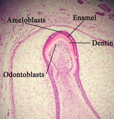 Developing tooth (labels) – histology slide
Histology of developing tooth with enamel, dentin, ameloblasts, and odontoblasts labeled. Tooth bud is in maturation/crown stage. (Description text from the Wikimedia Commons file page.)

Image by [url=https://commons.wikimedia.org/wiki/User:Dozenist]Dozenist[/url], via Wikimedia Commons. 

Original file source: [url=https://commons.wikimedia.org/wiki/File:Enamelmineralization11-17-05.jpg]https://commons.wikimedia.org/wiki/File:Enamelmineralization11-17-05.jpg[/url]

Title: "Enamelmineralization11-17-05.jpg"

No changes were made to the original image downloaded.  

Permission is granted to copy, distribute and/or modify this document under the terms of the GNU Free Documentation License, Version 1.2 or any later version published by the Free Software Foundation; with no Invariant Sections, no Front-Cover Texts, and no Back-Cover Texts. A copy of the license is included in the section entitled GNU Free Documentation License. [url=https://commons.wikimedia.org/wiki/Commons:GNU_Free_Documentation_License,_version_1.2]https://commons.wikimedia.org/wiki/Commons:GNU_Free_Documentation_License,_version_1.2[/url]

This file is licensed under the Creative Commons Attribution-ShareAlike 3.0 Unported license. [url=https://creativecommons.org/licenses/by-sa/3.0/deed.en]https://creativecommons.org/licenses/by-sa/3.0/deed.en[/url]

This file is licensed under the Creative Commons Attribution-ShareAlike [url=https://creativecommons.org/licenses/by-sa/2.5/deed.en]2.5 Generic[/url], [url=https://creativecommons.org/licenses/by-sa/2.0/deed.en]2.0 Generic[/url] and [url=https://creativecommons.org/licenses/by-sa/1.0/deed.en]1.0 Generic[/url] license.

Keywords: Developing Tooth – histology slide