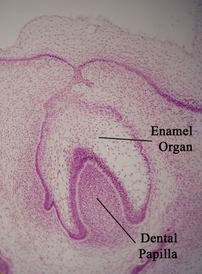 Developing tooth (labels) – histology slide
Histology of developing tooth with enamel organ and dental papilla labeled. (Description text from the Wikimedia Commons file page.)

Image by [url=https://commons.wikimedia.org/wiki/User:Dozenist]Dozenist[/url], via Wikimedia Commons. 

Original file source: [url=https://commons.wikimedia.org/wiki/File:Enamelorgan11-17-05.jpg]https://commons.wikimedia.org/wiki/File:Enamelorgan11-17-05.jpg[/url]

Title: "Enamelorgan11-17-05.jpg"

No changes were made to the original image downloaded.  

Permission is granted to copy, distribute and/or modify this document under the terms of the GNU Free Documentation License, Version 1.2 or any later version published by the Free Software Foundation; with no Invariant Sections, no Front-Cover Texts, and no Back-Cover Texts. A copy of the license is included in the section entitled GNU Free Documentation License. [url=https://commons.wikimedia.org/wiki/Commons:GNU_Free_Documentation_License,_version_1.2]https://commons.wikimedia.org/wiki/Commons:GNU_Free_Documentation_License,_version_1.2[/url]

This file is licensed under the Creative Commons Attribution-ShareAlike 3.0 Unported license. [url=https://creativecommons.org/licenses/by-sa/3.0/deed.en]https://creativecommons.org/licenses/by-sa/3.0/deed.en[/url]

This file is licensed under the Creative Commons Attribution-ShareAlike [url=https://creativecommons.org/licenses/by-sa/2.5/deed.en]2.5 Generic[/url], [url=https://creativecommons.org/licenses/by-sa/2.0/deed.en]2.0 Generic[/url] and [url=https://creativecommons.org/licenses/by-sa/1.0/deed.en]1.0 Generic[/url] license.

