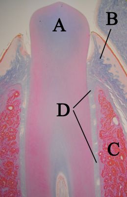 Erupting tooth (labels) – histology slide
Histologic slide of an erupting tooth with tooth (labeled A), gingiva (labeled B), alveolar bone (labeled C), and periodontal ligaments (labeled D). (Description text from the Wikimedia Commons file page.)

Image by [url=https://commons.wikimedia.org/wiki/User:Dozenist]Dozenist[/url], via Wikimedia Commons. 

Original file source: [url=https://commons.wikimedia.org/wiki/File:Eruptingtoothwithlabels11-24-05.jpg] https://commons.wikimedia.org/wiki/File:Eruptingtoothwithlabels11-24-05.jpg[/url]

Title: "Eruptingtoothwithlabels11-24-05.jpg"

No changes were made to the original image downloaded.  

Permission is granted to copy, distribute and/or modify this document under the terms of the GNU Free Documentation License, Version 1.2 or any later version published by the Free Software Foundation; with no Invariant Sections, no Front-Cover Texts, and no Back-Cover Texts. A copy of the license is included in the section entitled GNU Free Documentation License. [url=https://commons.wikimedia.org/wiki/Commons:GNU_Free_Documentation_License,_version_1.2]https://commons.wikimedia.org/wiki/Commons:GNU_Free_Documentation_License,_version_1.2[/url]

This file is licensed under the Creative Commons Attribution-ShareAlike 3.0 Unported license. [url=https://creativecommons.org/licenses/by-sa/3.0/deed.en]https://creativecommons.org/licenses/by-sa/3.0/deed.en[/url]

This file is licensed under the Creative Commons Attribution-ShareAlike [url=https://creativecommons.org/licenses/by-sa/2.5/deed.en]2.5 Generic[/url], [url=https://creativecommons.org/licenses/by-sa/2.0/deed.en]2.0 Generic[/url] and [url=https://creativecommons.org/licenses/by-sa/1.0/deed.en]1.0 Generic[/url] license.
