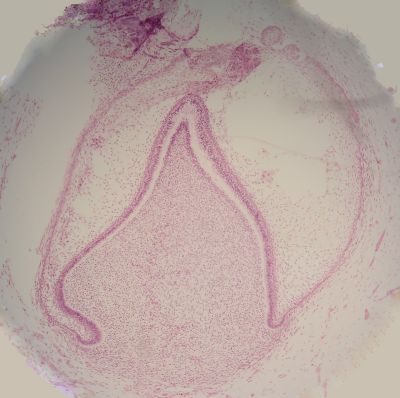 Developing tooth – histology slide
Histology of developing tooth with no labels. Tooth bud is in late bell stage. (Description text from the Wikimedia Commons file page.)

Image by [url=https://commons.wikimedia.org/wiki/User:Dozenist]Dozenist[/url], via Wikimedia Commons. 

Original file source: [url=https://commons.wikimedia.org/wiki/File:Latebellstage11-18-05.jpg]https://commons.wikimedia.org/wiki/File:Latebellstage11-18-05.jpg[/url]

Title: "Latebellstage11-18-05.jpg"

No changes were made to the original image downloaded.  

Permission is granted to copy, distribute and/or modify this document under the terms of the GNU Free Documentation License, Version 1.2 or any later version published by the Free Software Foundation; with no Invariant Sections, no Front-Cover Texts, and no Back-Cover Texts. A copy of the license is included in the section entitled GNU Free Documentation License. [url=https://commons.wikimedia.org/wiki/Commons:GNU_Free_Documentation_License,_version_1.2]https://commons.wikimedia.org/wiki/Commons:GNU_Free_Documentation_License,_version_1.2[/url]

This file is licensed under the Creative Commons Attribution-ShareAlike 3.0 Unported license. [url=https://creativecommons.org/licenses/by-sa/3.0/deed.en]https://creativecommons.org/licenses/by-sa/3.0/deed.en[/url]

This file is licensed under the Creative Commons Attribution-ShareAlike [url=https://creativecommons.org/licenses/by-sa/2.5/deed.en]2.5 Generic[/url], [url=https://creativecommons.org/licenses/by-sa/2.0/deed.en]2.0 Generic[/url] and [url=https://creativecommons.org/licenses/by-sa/1.0/deed.en]1.0 Generic[/url] license.

