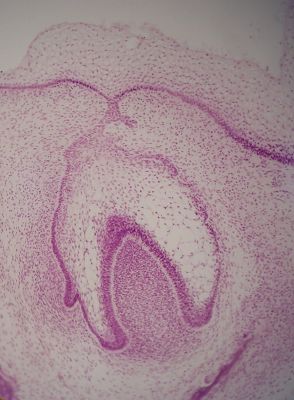 Developing tooth – histology slide
Histology of developing tooth with no labels. Cap stage is shown. (Description text from the Wikimedia Commons file page.)

Image by [url=https://commons.wikimedia.org/wiki/User:Dozenist]Dozenist[/url], via Wikimedia Commons. 

Original file source: [url=https://commons.wikimedia.org/wiki/File:Toothbud11-17-05.jpg]https://commons.wikimedia.org/wiki/File:Toothbud11-17-05.jpg [/url]

Title: "Toothbud11-17-05.jpg"

No changes were made to the original image downloaded.  

Permission is granted to copy, distribute and/or modify this document under the terms of the GNU Free Documentation License, Version 1.2 or any later version published by the Free Software Foundation; with no Invariant Sections, no Front-Cover Texts, and no Back-Cover Texts. A copy of the license is included in the section entitled GNU Free Documentation License. [url=https://commons.wikimedia.org/wiki/Commons:GNU_Free_Documentation_License,_version_1.2]https://commons.wikimedia.org/wiki/Commons:GNU_Free_Documentation_License,_version_1.2[/url]

This file is licensed under the Creative Commons Attribution-ShareAlike 3.0 Unported license. [url=https://creativecommons.org/licenses/by-sa/3.0/deed.en]https://creativecommons.org/licenses/by-sa/3.0/deed.en[/url]

This file is licensed under the Creative Commons Attribution-ShareAlike [url=https://creativecommons.org/licenses/by-sa/2.5/deed.en]2.5 Generic[/url], [url=https://creativecommons.org/licenses/by-sa/2.0/deed.en]2.0 Generic[/url] and [url=https://creativecommons.org/licenses/by-sa/1.0/deed.en]1.0 Generic[/url] license.

