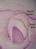 Dentallamina11-17-05.jpg