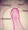 Enamelmineralization11-17-05.jpg