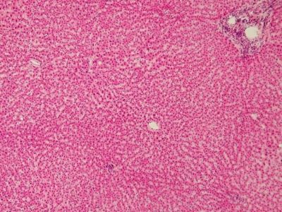 Human liver - histology slide
Image by Department of Histology, Jagiellonian University Medical College ([url=http://histologia.cm-uj.krakow.pl/index.html]1[/url]; [url=https://web.archive.org/web/20060216212659/http://www.histologia.cm-uj.krakow.pl/index.html]archive copy[/url] at the Wayback Machine), via Wikimedia Commons.

Original file source: [url=https://commons.wikimedia.org/wiki/File:Human_liver.jpg] https://commons.wikimedia.org/wiki/File:Human_liver.jpg[/url]
Title: "Human liver.jpg"

No changes were made to the original image downloaded. 

Permission is granted to copy, distribute and/or modify this document under the terms of the GNU Free Documentation License, Version 1.2 or any later version published by the Free Software Foundation; with no Invariant Sections, no Front-Cover Texts, and no Back-Cover Texts. A copy of the license is included in the section entitled GNU Free Documentation License. [url=https://commons.wikimedia.org/wiki/Commons:GNU_Free_Documentation_License,_version_1.2]https://commons.wikimedia.org/wiki/Commons:GNU_Free_Documentation_License,_version_1.2[/url]

This file is licensed under the Creative Commons Attribution-Share Alike 3.0 Unported License [url=https://creativecommons.org/licenses/by-sa/3.0/deed.en/]https://creativecommons.org/licenses/by-sa/3.0/deed.en/[/url]
