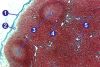 512px-Lymphknoten_28Schwein29.jpg