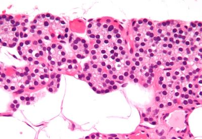 Parathyroid gland - histology slide
This image shows a histology slide of the parathyroid gland.

Image by [url=https://commons.wikimedia.org/wiki/User:Nephron]Nephron[/url], via Wikimedia Commons.

Original file source: [url=https://commons.wikimedia.org/wiki/File:Parathyroid_gland_high_mag_cropped.jpg] https://commons.wikimedia.org/wiki/File:Parathyroid_gland_high_mag_cropped.jpg [/url]

Title: "Parathyrod_gland_high_mag_cropped.jpg"

No changes were made to the original image downloaded (note: this version was downloaded at reduced resolution from Wikimedia Commons).

This file is licensed under the Creative Commons Attribution-Share Alike 3.0 Unported License [url=https://creativecommons.org/licenses/by-sa/3.0/deed.en]https://creativecommons.org/licenses/by-sa/3.0/deed.en[/url].

Copyright © 2009 Michael Bonert, MD, FRCPC ([url=https://commons.wikimedia.org/wiki/User:Nephron]https://commons.wikimedia.org/wiki/User:Nephron[/url] / [url=https://experts.mcmaster.ca/display/bonertm]https://experts.mcmaster.ca/display/bonertm[/url])

You are free to share and adapt this image as per the CC BY-SA 3.0 ([url=https://creativecommons.org/licenses/by-sa/3.0/legalcode]https://creativecommons.org/licenses/by-sa/3.0/legalcode[/url])



