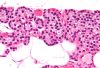 Parathyroid_gland_high_mag_cropped.jpg