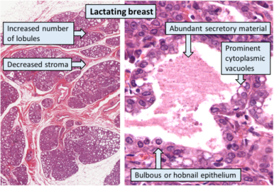 Lactating breast (labels) - histology slide
This is a histology slide of a lactating breast. H&E stain.  

Histology slide courtesy of Mikael Häggström, M.D., via Wikimedia Commons. No changes were made from the download.  

Original file source: [url=https://commons.wikimedia.org/wiki/File:Histology_of_lactating_breast,_annotated.png]https://commons.wikimedia.org/wiki/File:Histology_of_lactating_breast,_annotated.png[/url]

