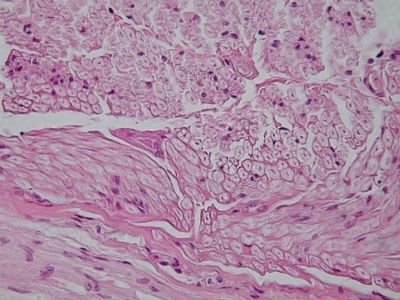 Peripheral nerve, cross section - histology slide
Image by Department of Histology, Jagiellonian University Medical College ([url=http://histologia.cm-uj.krakow.pl/index.html]1[/url]; [url=https://web.archive.org/web/20060216212659/http://www.histologia.cm-uj.krakow.pl/index.html]archive copy[/url] at the Wayback Machine), via Wikimedia Commons.

Original file source: [url=https://commons.wikimedia.org/wiki/File:Peripheral_nerve,_cross_section.jpg]https://commons.wikimedia.org/wiki/File:Peripheral_nerve,_cross_section.jpg[/url]

Title: "Peripheral nerve, cross section.jpg"

No changes were made to the original image downloaded. 

Permission is granted to copy, distribute and/or modify this document under the terms of the GNU Free Documentation License, Version 1.2 or any later version published by the Free Software Foundation; with no Invariant Sections, no Front-Cover Texts, and no Back-Cover Texts. A copy of the license is included in the section entitled GNU Free Documentation License. [url=https://commons.wikimedia.org/wiki/Commons:GNU_Free_Documentation_License,_version_1.2]https://commons.wikimedia.org/wiki/Commons:GNU_Free_Documentation_License,_version_1.2[/url]

This file is licensed under the Creative Commons Attribution-Share Alike 3.0 Unported License [url=https://creativecommons.org/licenses/by-sa/3.0/deed.en/]https://creativecommons.org/licenses/by-sa/3.0/deed.en/[/url]
