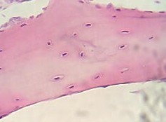 Cartilage - histology slide
Image by Fanny CASTETS, via Wikimedia Commons. 

Original file source: [url=https://commons.wikimedia.org/wiki/File:Cartilage.jpg]https://commons.wikimedia.org/wiki/File:Cartilage.jpg[/url]

Title: "Cartilage.jpg"

No changes were made to the original image downloaded.  

Permission is granted to copy, distribute and/or modify this document under the terms of the GNU Free Documentation License, Version 1.2 or any later version published by the Free Software Foundation; with no Invariant Sections, no Front-Cover Texts, and no Back-Cover Texts. A copy of the license is included in the section entitled GNU Free Documentation License. [url=https://commons.wikimedia.org/wiki/Commons:GNU_Free_Documentation_License,_version_1.2]https://commons.wikimedia.org/wiki/Commons:GNU_Free_Documentation_License,_version_1.2[/url]

This file is licensed under the Creative Commons Attribution-Share Alike 3.0 Unported License [url=https://creativecommons.org/licenses/by-sa/3.0/deed.en/]https://creativecommons.org/licenses/by-sa/3.0/deed.en/[/url]

This file is licensed under the Creative Commons Attribution 2.5 Generic license. [url=https://creativecommons.org/licenses/by/2.5/deed.en]https://creativecommons.org/licenses/by/2.5/deed.en[/url]


