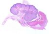512px-Fetal_kidney_23_weeks.jpg