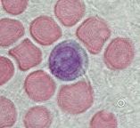Lymphocyte - histology slide
Image by Department of Histology, Jagiellonian University Medical College ([url=http://histologia.cm-uj.krakow.pl/index.html]1[/url]; [url=https://web.archive.org/web/20060216212659/http://www.histologia.cm-uj.krakow.pl/index.html]archive copy[/url] at the Wayback Machine), via Wikimedia Commons.

Original file source: [url=https://commons.wikimedia.org/wiki/File:Lymphocyte.jpg]https://commons.wikimedia.org/wiki/File:Lymphocyte.jpg[/url]

Title: "Lymphocyte.jpg"

No changes were made to the original image downloaded. 

Permission is granted to copy, distribute and/or modify this document under the terms of the GNU Free Documentation License, Version 1.2 or any later version published by the Free Software Foundation; with no Invariant Sections, no Front-Cover Texts, and no Back-Cover Texts. A copy of the license is included in the section entitled GNU Free Documentation License. [url=https://commons.wikimedia.org/wiki/Commons:GNU_Free_Documentation_License,_version_1.2]https://commons.wikimedia.org/wiki/Commons:GNU_Free_Documentation_License,_version_1.2[/url]

This file is licensed under the Creative Commons Attribution-Share Alike 3.0 Unported License [url=https://creativecommons.org/licenses/by-sa/3.0/deed.en/]https://creativecommons.org/licenses/by-sa/3.0/deed.en/[/url]
