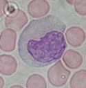 Monocyte - histology slide
Image by Department of Histology, Jagiellonian University Medical College ([url=http://histologia.cm-uj.krakow.pl/index.html]1[/url]; [url=https://web.archive.org/web/20060216212659/http://www.histologia.cm-uj.krakow.pl/index.html]archive copy[/url] at the Wayback Machine), via Wikimedia Commons.

Original file source: [url=https://commons.wikimedia.org/wiki/File:Monocyte.jpg]https://commons.wikimedia.org/wiki/File:Monocyte.jpg[/url]

Title: "Monocyte.jpg"

No changes were made to the original image downloaded. 

Permission is granted to copy, distribute and/or modify this document under the terms of the GNU Free Documentation License, Version 1.2 or any later version published by the Free Software Foundation; with no Invariant Sections, no Front-Cover Texts, and no Back-Cover Texts. A copy of the license is included in the section entitled GNU Free Documentation License. [url=https://commons.wikimedia.org/wiki/Commons:GNU_Free_Documentation_License,_version_1.2]https://commons.wikimedia.org/wiki/Commons:GNU_Free_Documentation_License,_version_1.2[/url]

This file is licensed under the Creative Commons Attribution-Share Alike 3.0 Unported License [url=https://creativecommons.org/licenses/by-sa/3.0/deed.en/]https://creativecommons.org/licenses/by-sa/3.0/deed.en/[/url]

