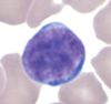 Filename=Lymphocyte_GL.jpg
Filesize=16KiB
Dimensions=417x393
Date added=Oct 21, 2025 Lymphocyte_GL.jpg