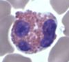Filename=WBC_eosinophil.jpg
Filesize=21KiB
Dimensions=429x384
Date added=Oct 21, 2025 WBC_eosinophil.jpg