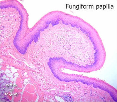 Tongue Histology - Fungiform papillae - histology slide